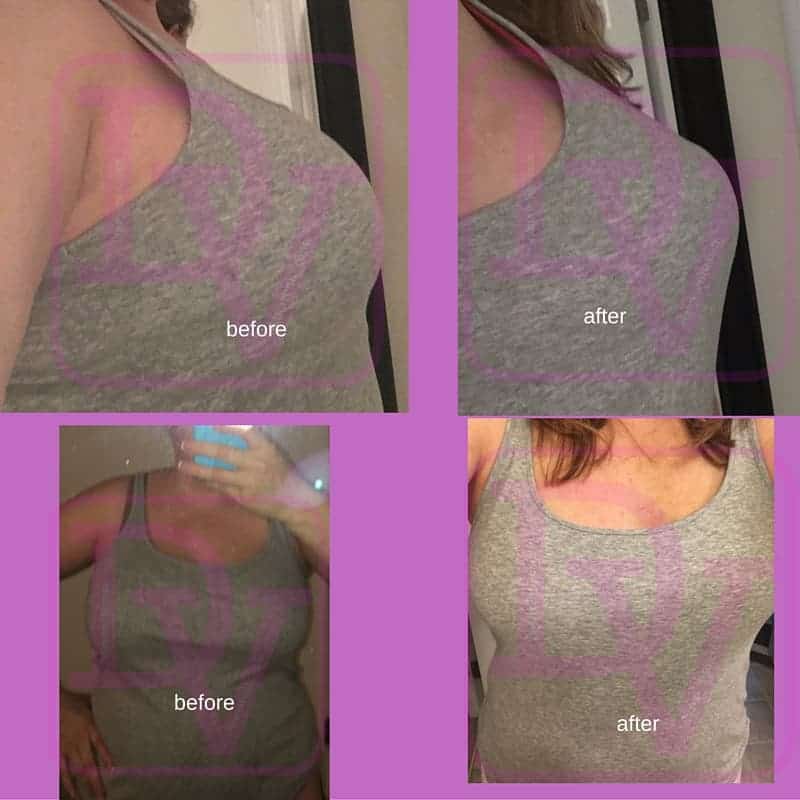 Before and after Breast reduction surgery in gray tank top 