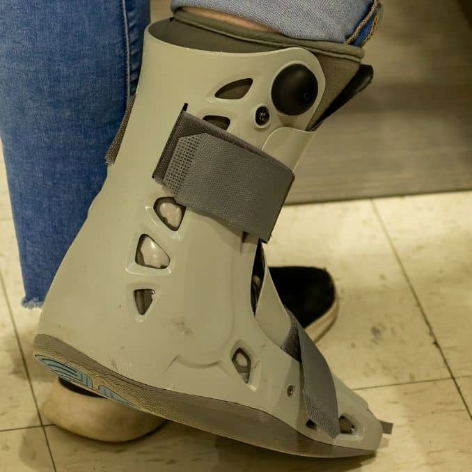 Walking Boot Air Cast Cleaning Tips